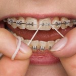 braces flossing