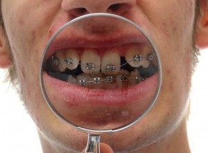 problem teeth