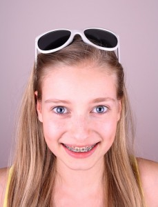 orthodontic braces